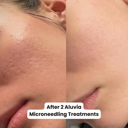 M8 MicroneedIing Pen